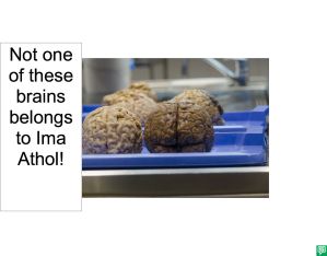NOT ONE OF THESE BRAINS BELONGS TO IMA ATHOL